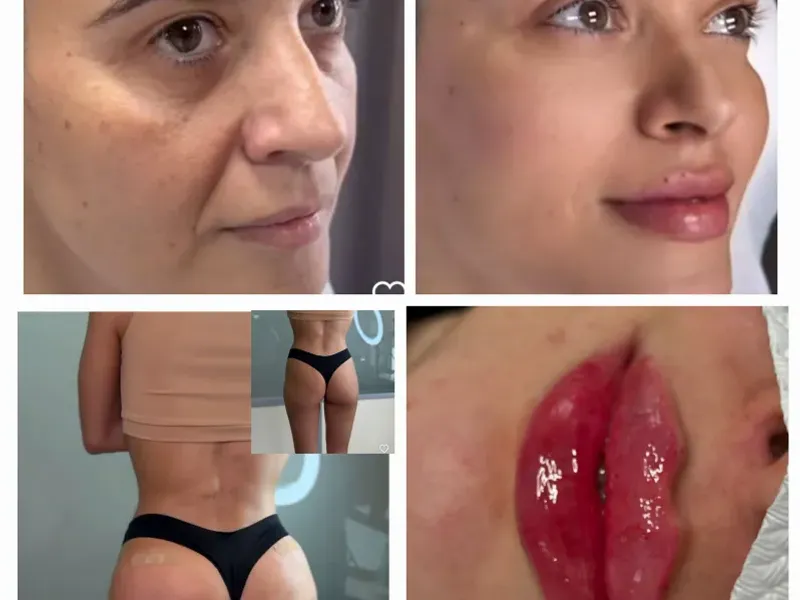 Armonización  facial, rejuvenecimiento y productos estrellas  ⭐️ de la Estética 