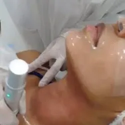 Hidratación de cuello y escote con ácido hialurónico 