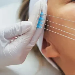 Hilos Tensores Espiculados 