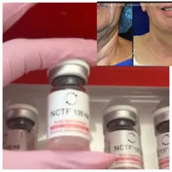 NCTF-135 ha ( Redensificador facial) 