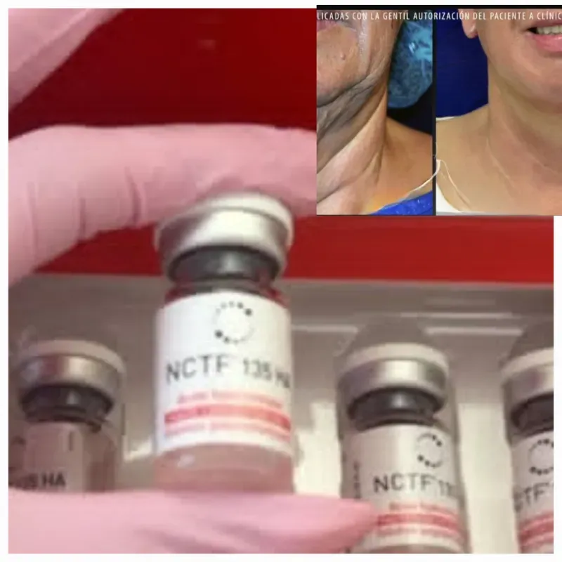 NCTF-135 ha ( Redensificador facial) 