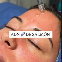 Terapia con ADN o esperma de Salmón 