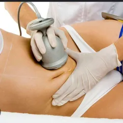 Ultracavitacion 