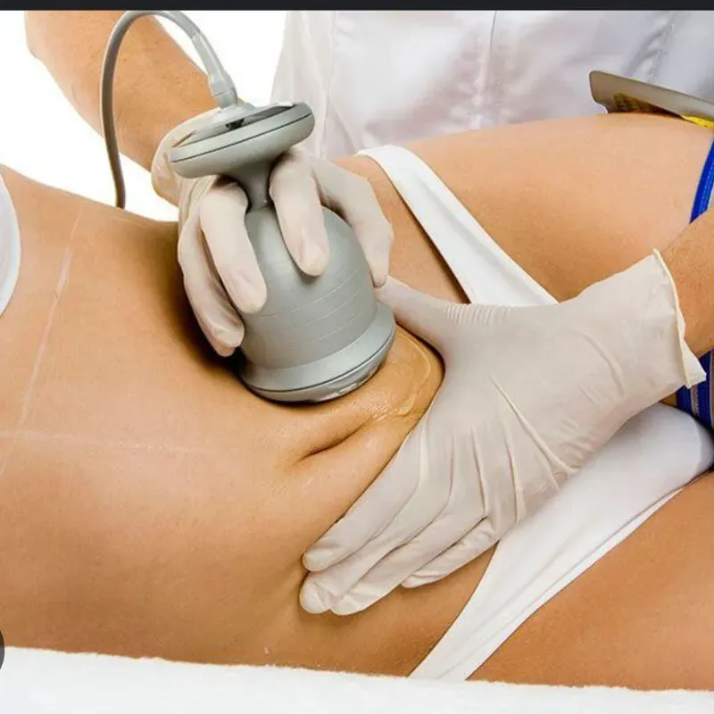 Ultracavitacion 
