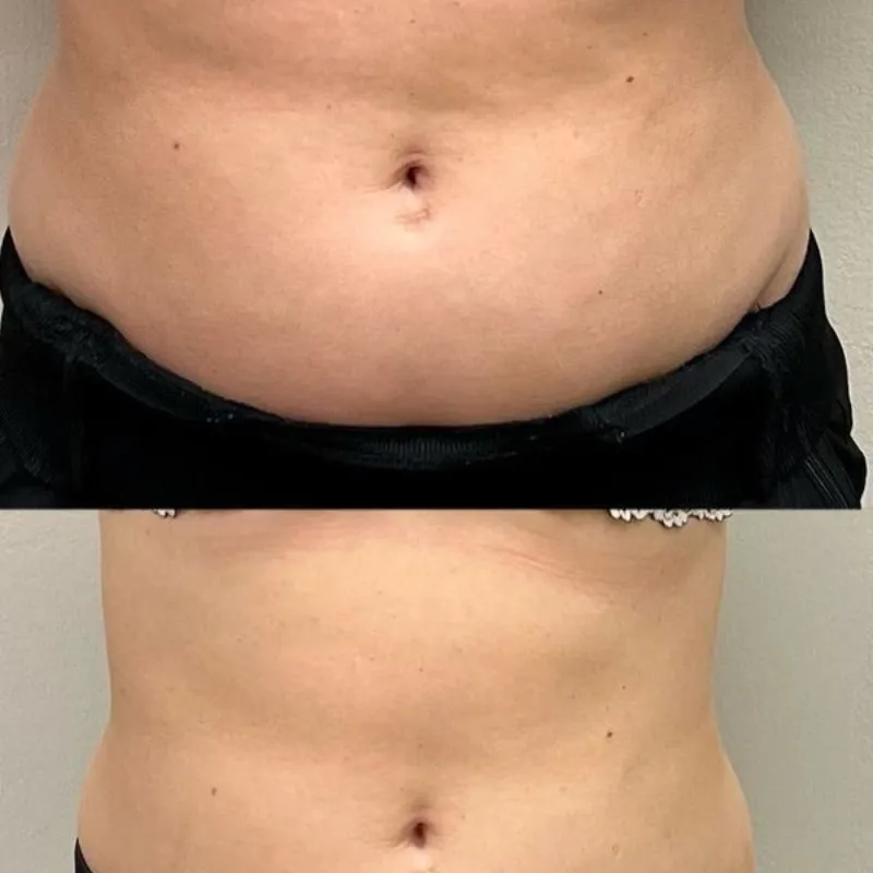 🌿 MADEROTERAPIA (Por área)