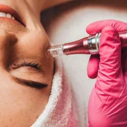 🌿Microneedling Facial