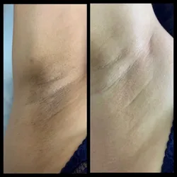 🌿PEELINGS DESPIGMENTANTES