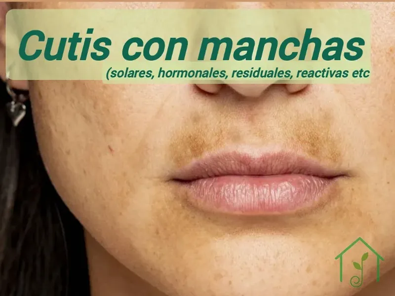 Cutis con manchas
