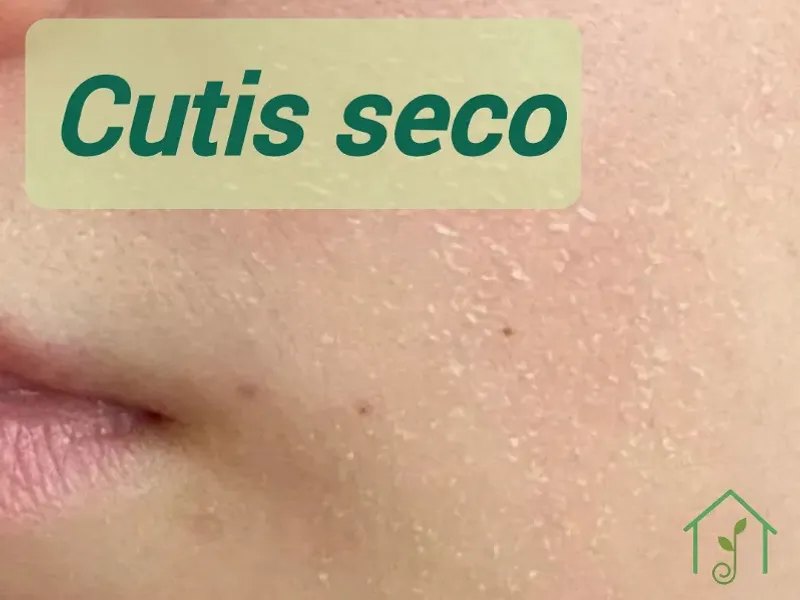 Cutis seco