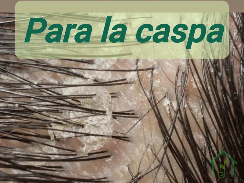 Para la caspa