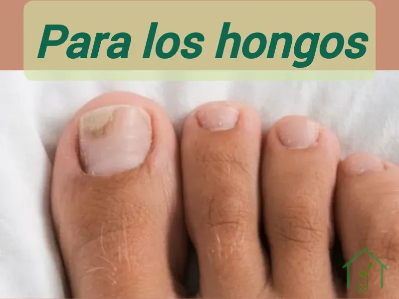 Para los hongos