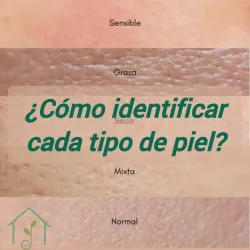 Tipos de piel