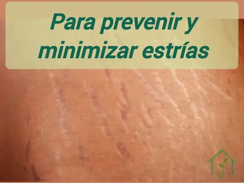 Para prevenir y minimizar estrías