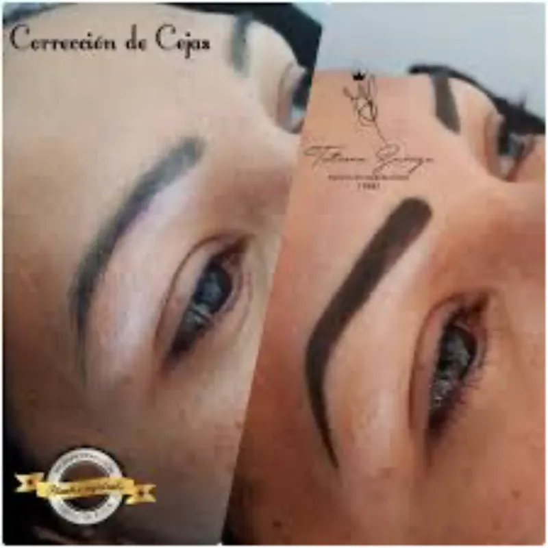 Corrección de Cejas 