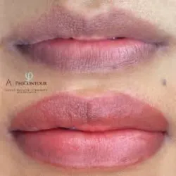 Corrección de Color en Labios 