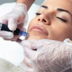 Mesoterapia facial con dermapen 
