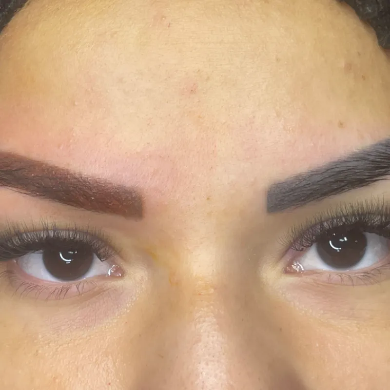 Neutralización de cejas 