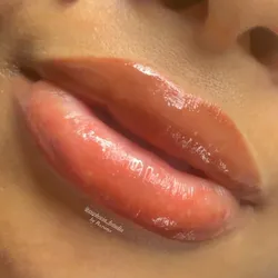 Neutralizacion  de labios 