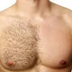 Pecho Masculino 