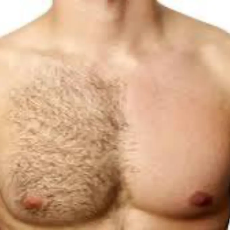 Pecho Masculino 
