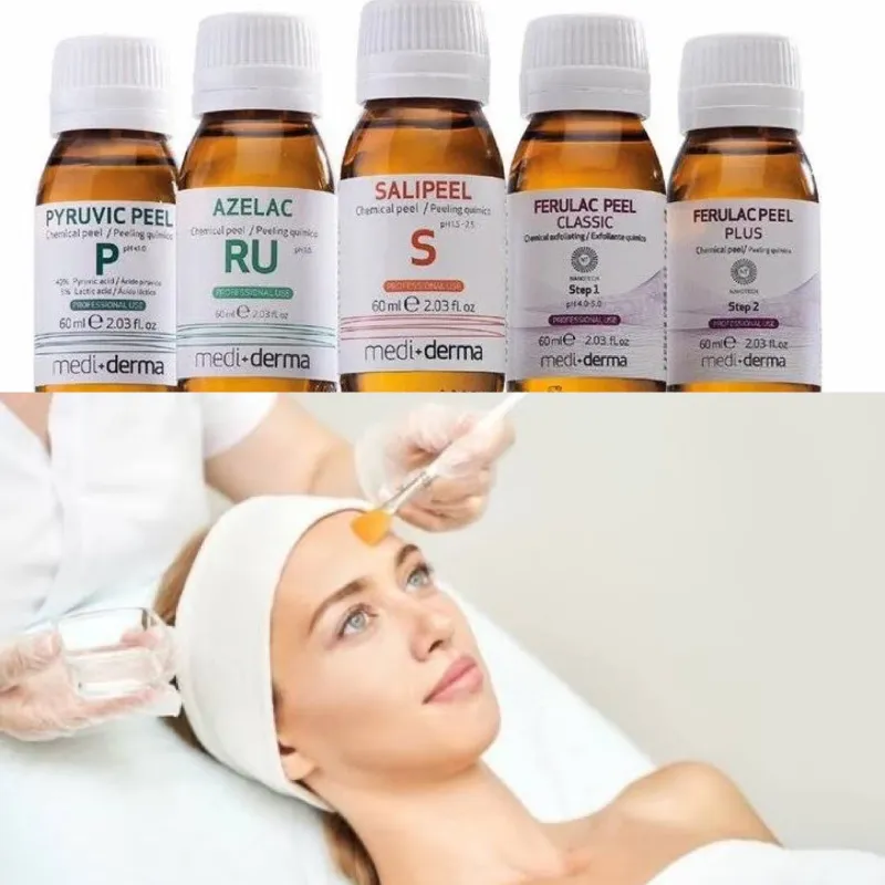 Tratamiento Peeling químico 