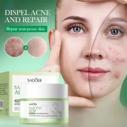 Crema de Ácido Salicílico al 3% - Sadoer