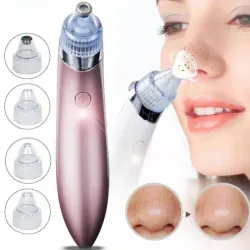 Extractor de Puntos Negros 