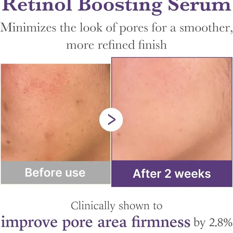 Sérum Boosting de Retinol 1.9% + NMN - Medicube