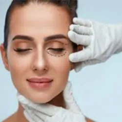 Blefaroplastia