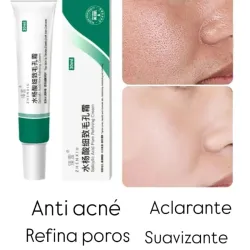 Crema de Ácido Salicílico