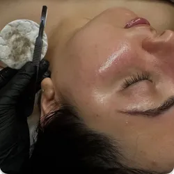 Dermaplaning