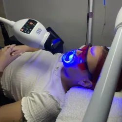 Limpieza y blanqueamiento dental