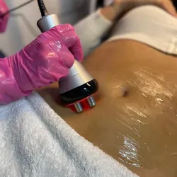 Radiofrecuencia corporal