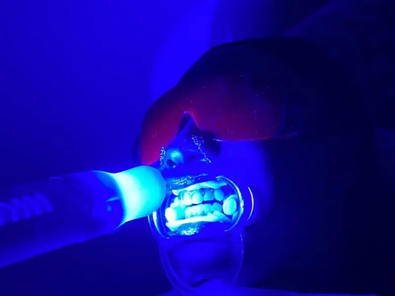 Blanqueamiento dental