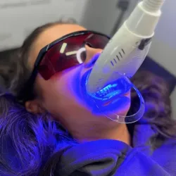 Blanqueamiento dental