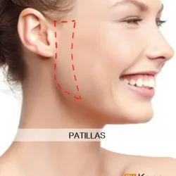Patillas 