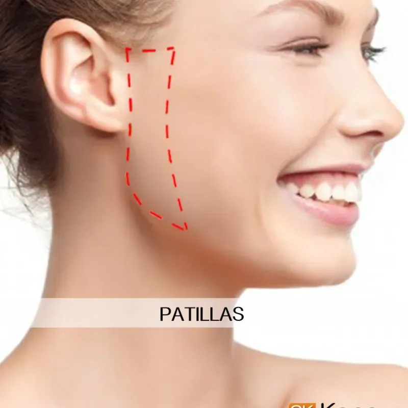 Patillas 