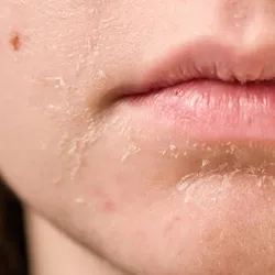 💧Tratamiento nutritivo e hidratante 