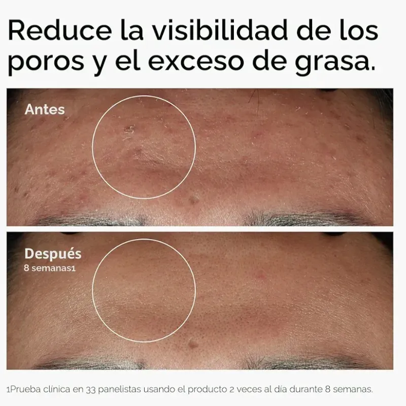 Niacinamide 10% + Zinc 1% - ORDINARY