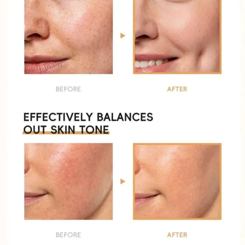 Set LAIKOU Rice: Nutrición y Poros Perfectos ✨🌾