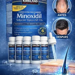 🔥 Tratamiento Recupera Tu Cabello — Minoxidil 5% Kirkland (Pack x6)