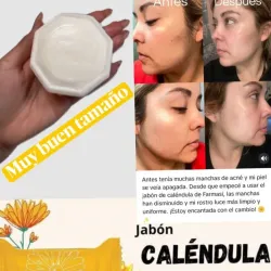  ¡Transformación REAL con el ¡Transformación REAL con el Jabón de Caléndula Farmasi! 🌼