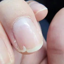 Reparación uña (c/u) 