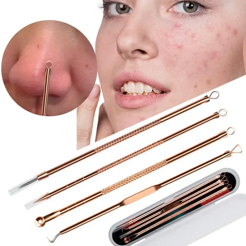 Extractor de espinillas