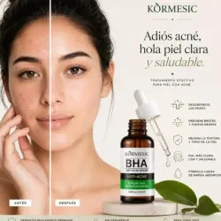 Serums antiacne