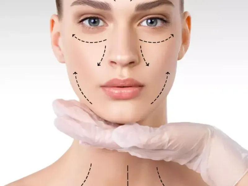 ARMONIZACIÓN FACIAL