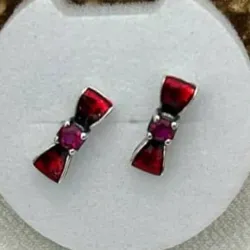 Aretes
