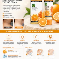 🍊Crema de vitamina C para Manchas de axilas y cuello🍊