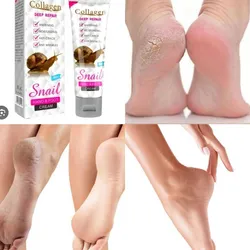 🧴Crema para Pies Agrietados y Manosi🧴