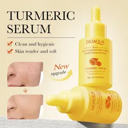 ✨Serum Bioaqua de cúrcuma antiacné✨